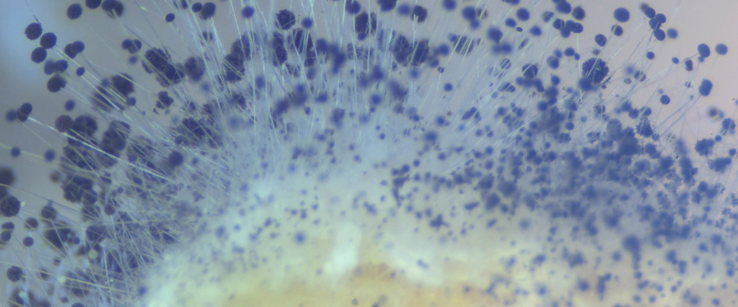 mold microscopic view LAFAYETTE LA 1